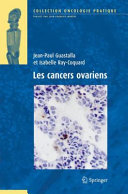 Les cancers ovariens /