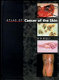 Atlas of cancer of the skin /