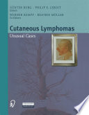 Cutaneous lymphomas : unusual cases /