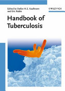Handbook of tuberculosis.