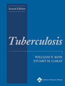 Tuberculosis /