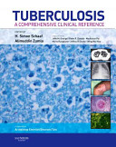 Tuberculosis : a comprehensive clinical reference /