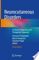 Neurocutaneous Disorders : A Clinical, Diagnostic and Therapeutic Approach /