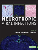 Neurotropic viral infections /