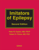 Imitators of epilepsy /