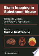 Brain imaging in substance abuse : research, clinical, and forensic applications /