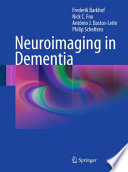 Neuroimaging in dementia /