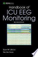 Handbook of ICU EEG monitoring /