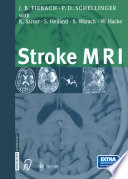 Stroke MRI /