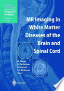 MR imaging in white matter diseases of the brain and spinal cord /