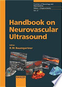 Handbook on neurovascular ultrasound /