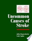 Uncommon causes of stroke /