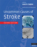 Uncommon causes of stroke /