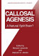 Callosal agenesis : a natural split brain? /