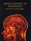 Brain imaging in psychiatry /