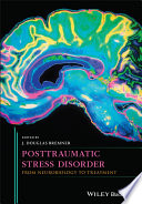Posttraumatic stress disorder : from neurobiology to treatment /