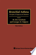 Bronchial asthma : principles of diagnosis and treatment /