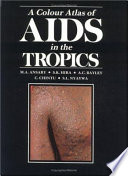 A Colour atlas of AIDS in the tropics /