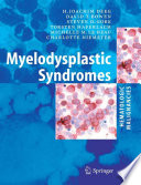 Hematologic malignancies : myelodysplastic syndromes /