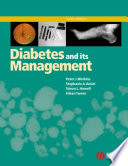 Diabetes and its management.