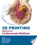 3D printing applications in cardiovascular medicine /