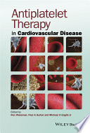 Antiplatelet therapy in cardiovascular disease /