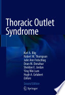 Thoracic Outlet Syndrome /