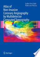 Atlas of non-invasive coronary angiography by multidetector computed tomography /