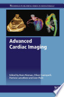 Advanced cardiac imaging /