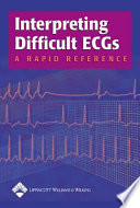 Interpreting difficult ECGs : a rapid reference.