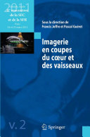 Imagerie en coupes du cœur et des vaisseaux : Compte rendu des 4es rencontres de la SFC et de la SFR : Paris, 24 et 25 mars 2011 /
