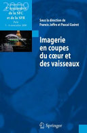 Imagerie en coupes du coeur et des vaisseaux : compte rendu des 3es rencontres de la SFC et de la SFR : Paris, 5 et 6 novembre 2009 /
