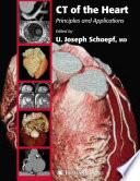 CT of the heart : principles and applications /