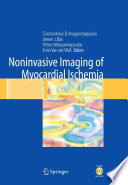 Noninvasive imaging of myocardial ischemia /