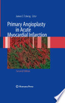 Primary angioplasty in acute myocardial infarction /