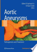 Aortic aneurysms : pathogenesis and treatment /