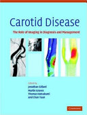 Carotid disease : the role of imaging in diagnosis and management /