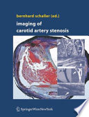 Imaging of carotid artery stenosis /