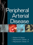 Peripheral arterial disease /