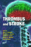 Thrombus and stroke /