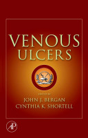 Venous ulcers /