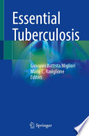 Essential Tuberculosis /