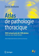 Atlas de pathologie thoracique /