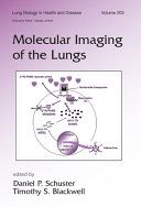 Molecular imaging of the lungs /