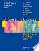 Diffuse lung diseases : clinical features, pathology, HRCT /