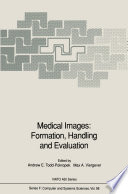 Medical images : formation, handling, and evaluation /