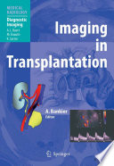 Imaging in transplantation /