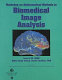 Proceedings : IEEE Workshop on Mathematical Methods in Biomedical Image Analysis : MMBIA-2000 : Hilton Head Island, South Carolina, June 11-12, 2000 /