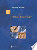 Virtual endoscopy /