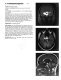 MRI, a teaching file approach /